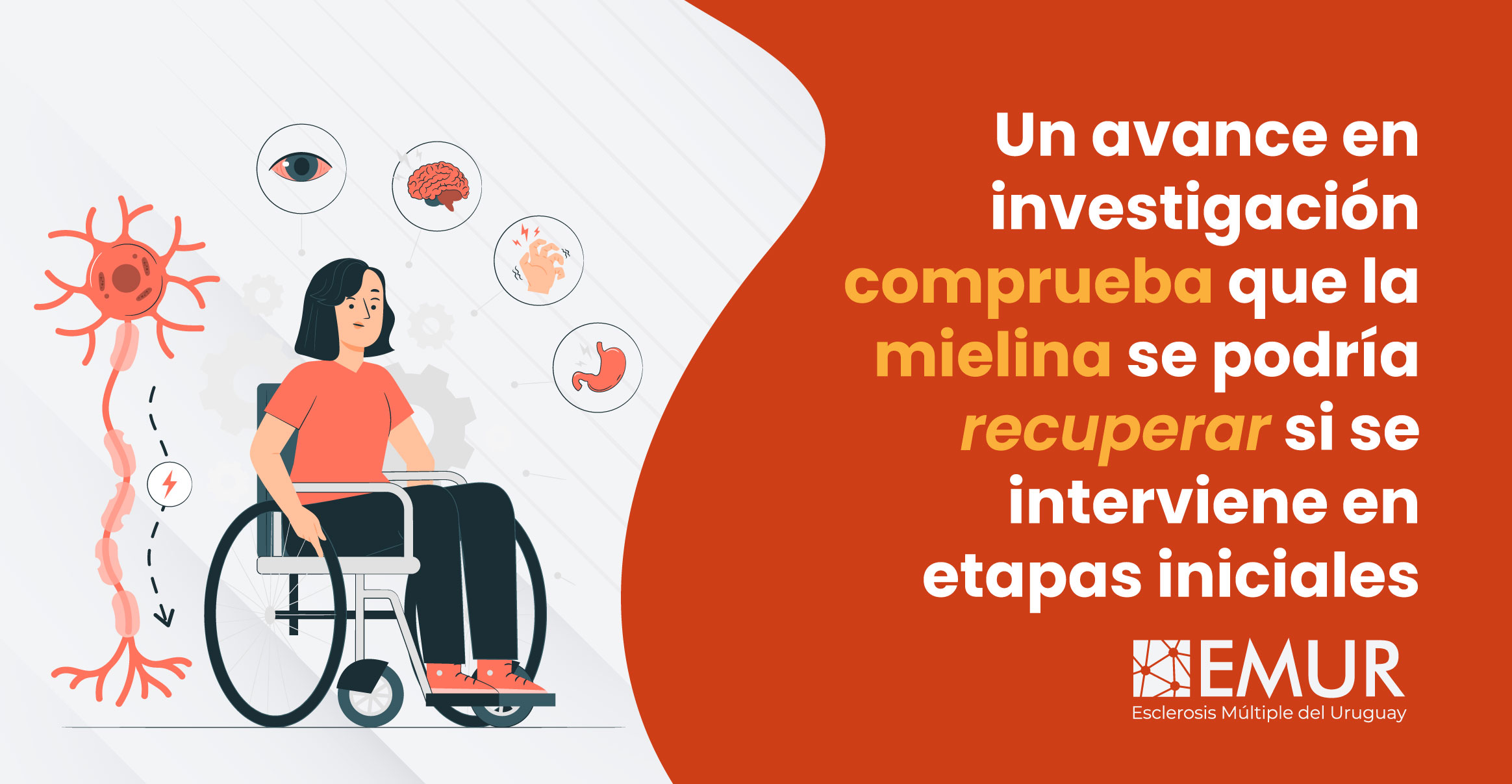 Un avance en investigación comprueba que la mielina se podría recuperar si se interviene en etapas iniciales.